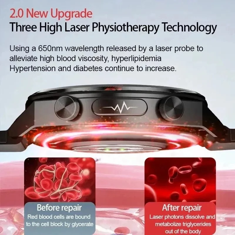 2024 Neue Laserbehandlung Drei hohe Smart Watch Männer EKG PPG Herzfrequenz Blutzucker Gesundheitstracker Smart Watches für Huawei IOS