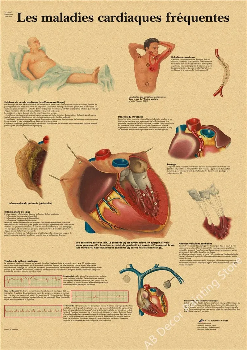 Retro-Organsysteme im menschlichen Körper Poster Skelett Anatomie Kraftpapier Drucke DIY Vintage Home Zimmer Kunst Wand Dekor Gemälde