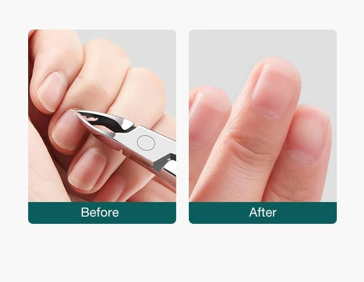 Nagelhautzange Nagelmaniküre Nagelhautschere Clippers Trimmer Dead Skin Remover Pediküre Edelstahlschneider Werkzeug