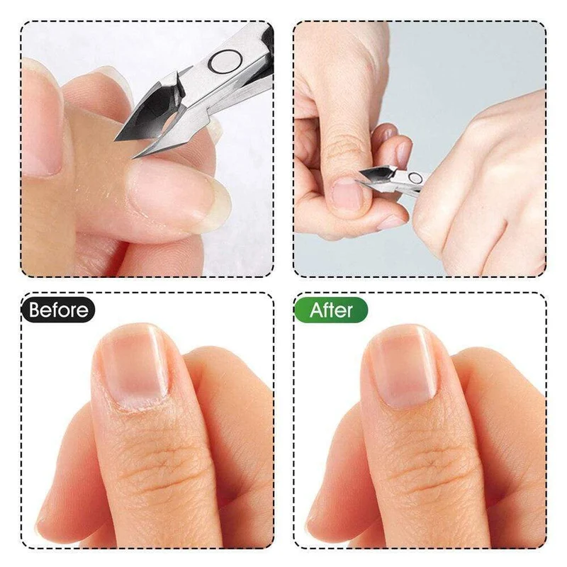 Doppelseitige Nägel Nagelhautschieber Finger Abgestorbene Haut Entferner Nagelzange Cutter für Maniküre Pediküre Zubehör Kunst Werkzeug Sets