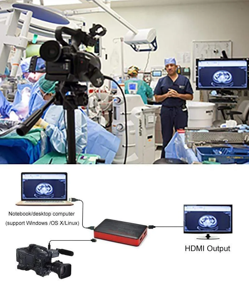 261 1080P 60fps Audio-Video-Aufnahmekarte für iOS-Telefonspiel HD-Kamera-Aufnahmebox HDMI auf USB 3.0 PC Live-Streaming-Platte