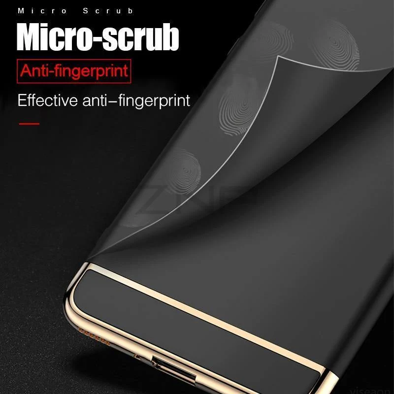 ZNP Luxury Electroplate Shockproof Case For Xiaomi Mi 6 5 5S Plus Hard Back Cover Cases For Xiaomi Mi 6 5 5X 5C Phone Case shell