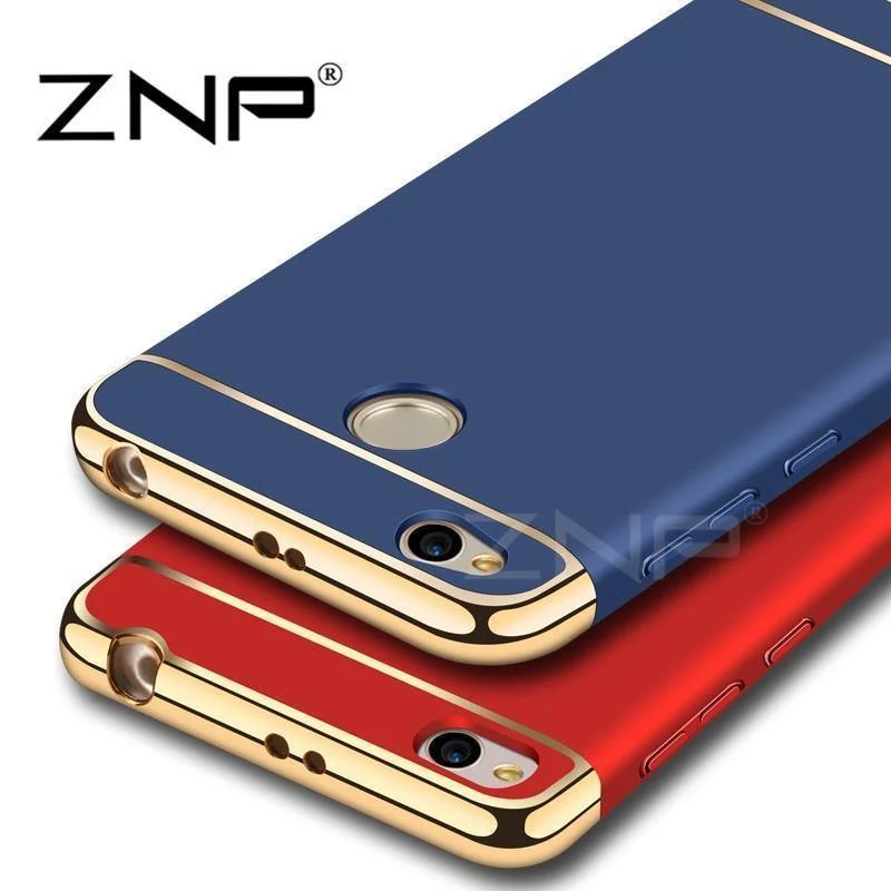 ZNP Luxus-Hartschale, galvanisierte, stoßfeste Hüllen für Xiaomi Redmi 4X Hülle 4X Telefonabdeckung für Redmi 4X Hülle Schutzhülle