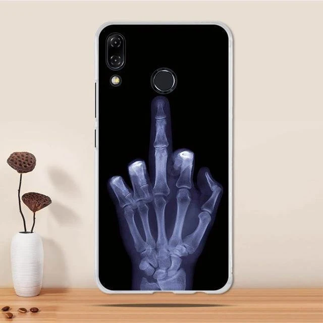Case for Asus Zenfone 5z ZS620KL / Zenfone 5 ZE620KL Case Cover Silicone TPU Coque Funda for Asus Zenfone 5 ZE620KL Case Cover