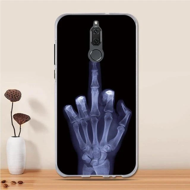 3D Case For Huawei Mate 10 Lite Case Cover Silicon for Huawei Nova 2i Case Cover Huawei Mate 10 Lite 10lite/ Nova 2i / Honor 9i