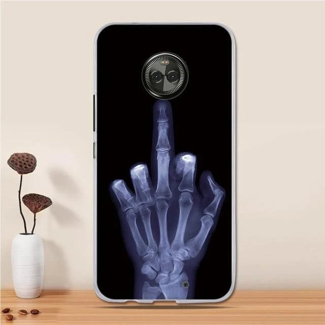 Case for Motorola Moto X4 Case Cover for Motorola Moto XT1900 X 2017 (4th gen) Cover 3D TPU Silicon for Motorola Moto X4 Coque