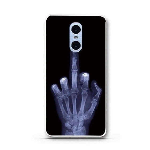 Phone Case for Xiaomi Redmi Note 4 Cover Case Soft Silicone Case For Xiaomi Redmi Note 4X Case Cover for Redmi Note 4 X Coque 3D