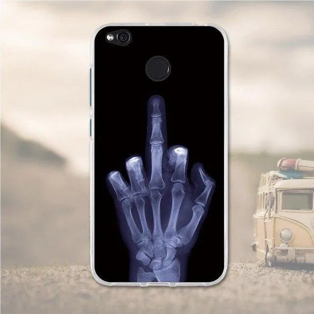 Cases For Xiaomi Redmi 4X Case Cover Silicon Cute Cover For Xiaomi Redmi 4X Pro Case Cover For Xiaomi Redmi 4X Phone case Fundas