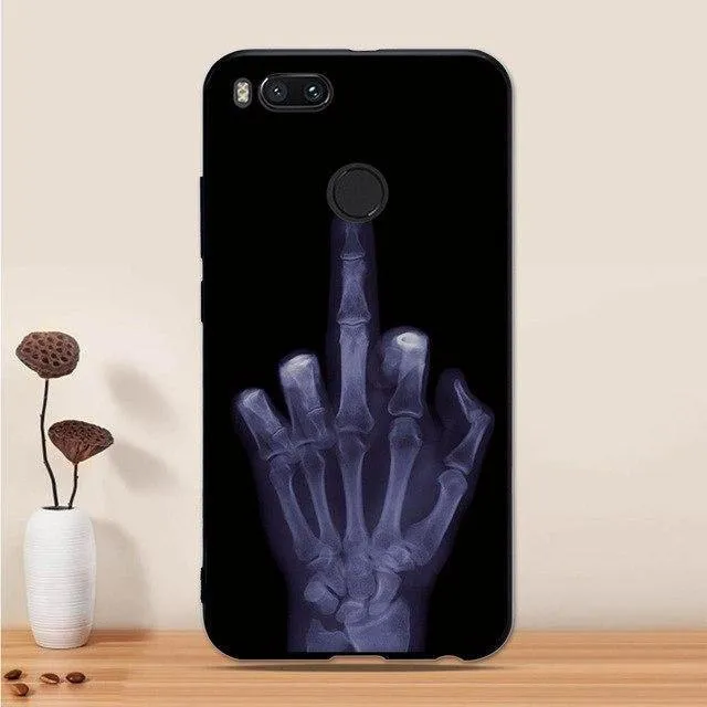 Für Funda Xiaomi Mi A1 Fall Abdeckung Silikon Weiche Tpu Coque Für Xiaomi Mi A1 A 1 Abdeckung Telefon Fall für Xiaomi Mi 5X Mi5x MiA1 Abdeckung
